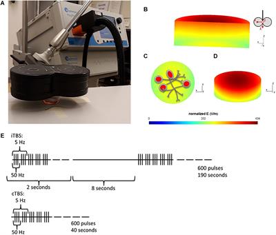 Transcranial Magnetic Stimulation-Induced Plasticity Mechanisms: TMS-Related Gene Expression and Morphology Changes in a Human Neuron-Like Cell Model